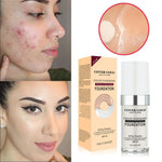 Concealing Foundation Temperature Change Skin Color - Concealing Foundation Temperature: Your Skin’s Chameleon