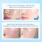 Deep Cleansing Facial Cleanser for Clear Radiant Skin Care Routine