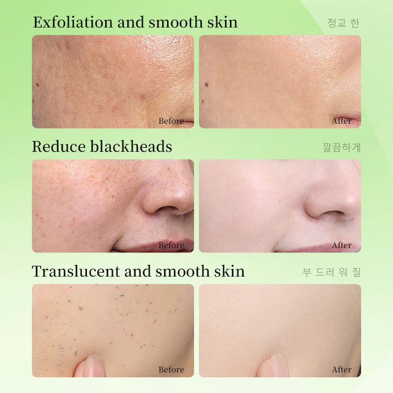Deep Cleansing Facial Cleanser for Glowing Skin and Pore Refinement