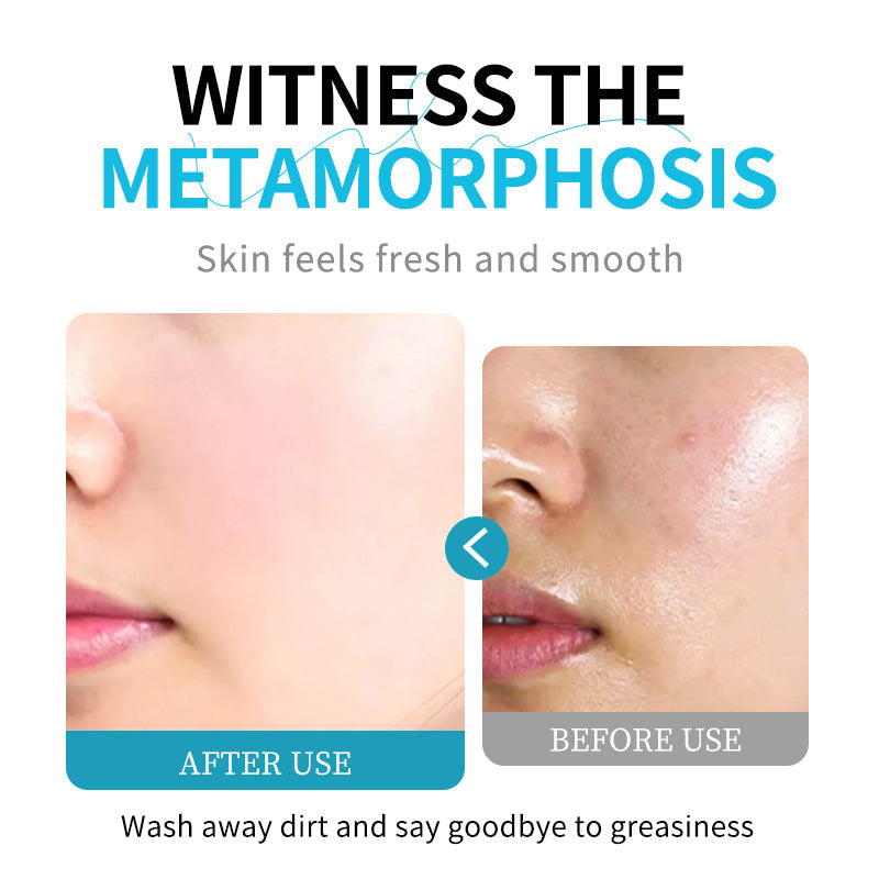 Deep Cleansing Facial Cleanser for Radiant Skin and Pore Refinement