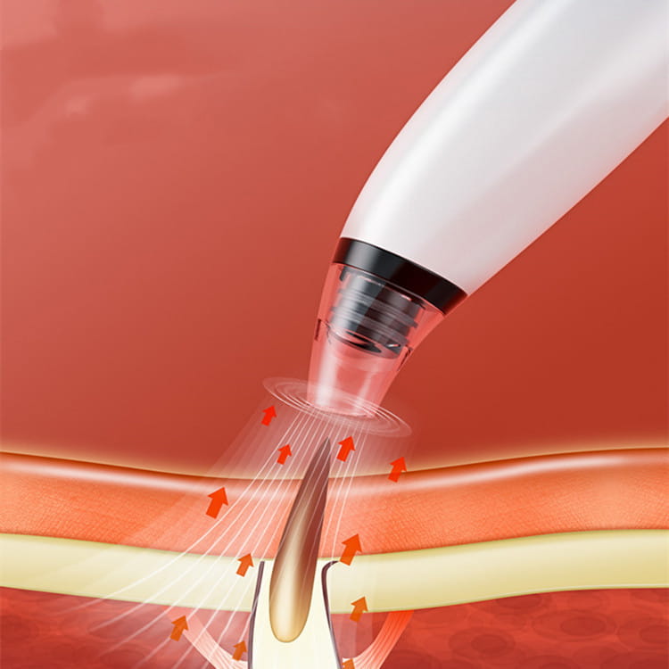 Retirer les points noirs et les pores, enlever l'acné, absorber les petites bulles et charger