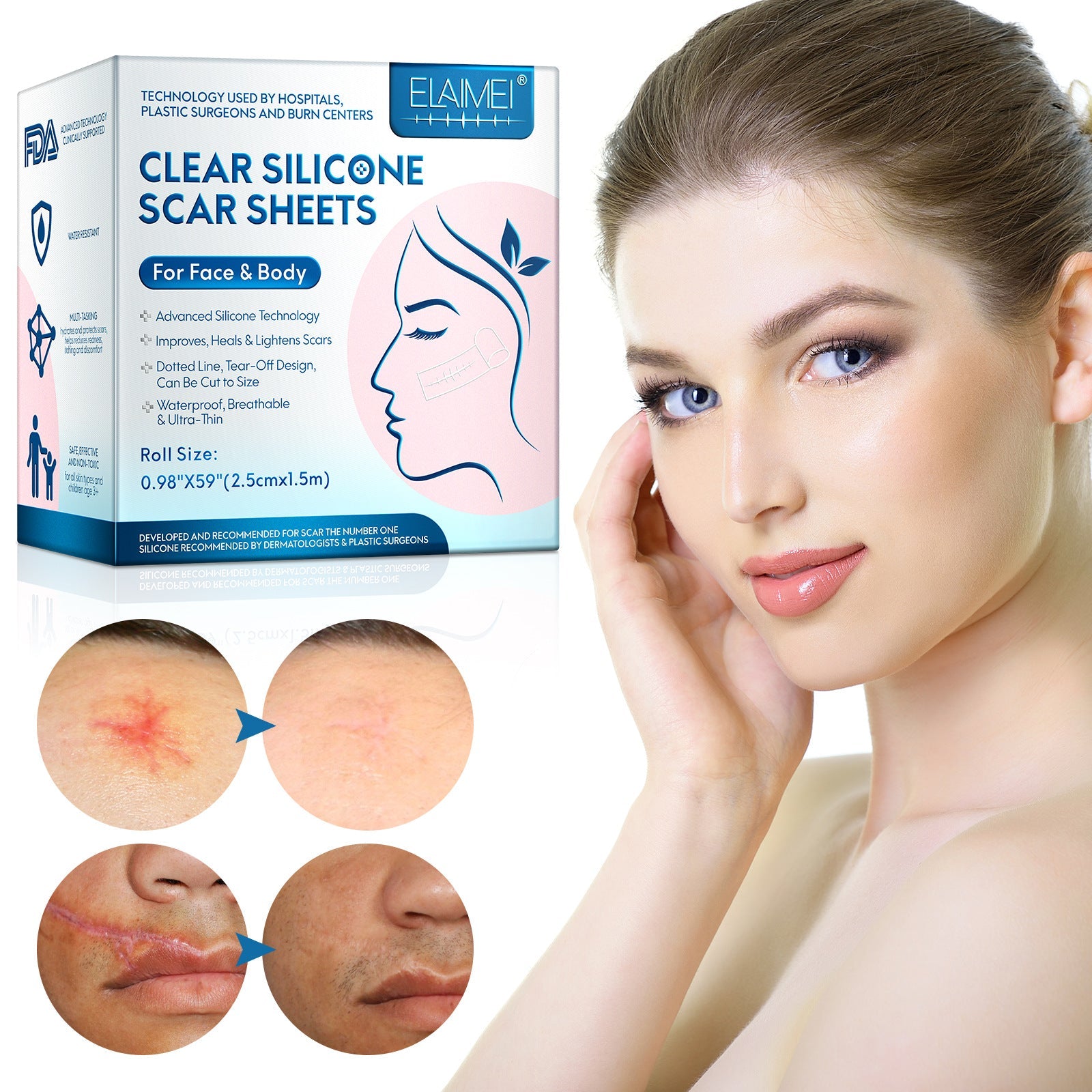 Elaimei Facial Invisible Scar Sticker Roll for Concealing Scars - elaimei facial invisible scar sticker roll