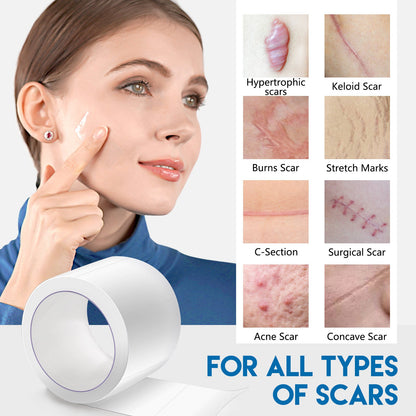 Elaimei Facial Invisible Scar Sticker Roll for Concealing Scars - elaimei facial invisible scar sticker roll