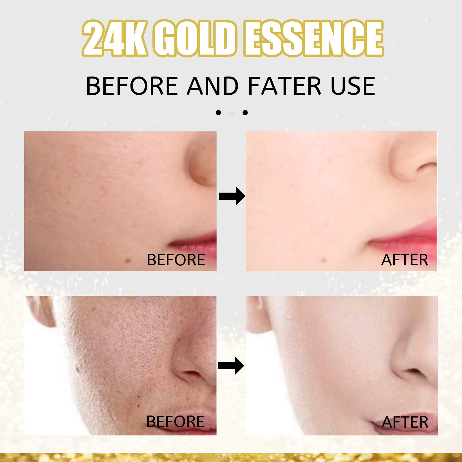 Electric Eye Beautification Instrument with Lifting Inductive Vibration Pink - Teleplus electric eye beautification