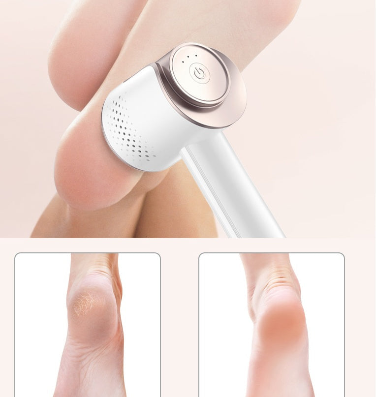 Electric Foot Grinder for Removing Dead Skin with Rechargeable Battery - Silky Smooth Feet Without Drama electric foot
