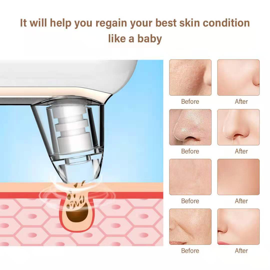 Electric Pore Vacuum Blackhead Remover Facial Cleansing Beauty Tool