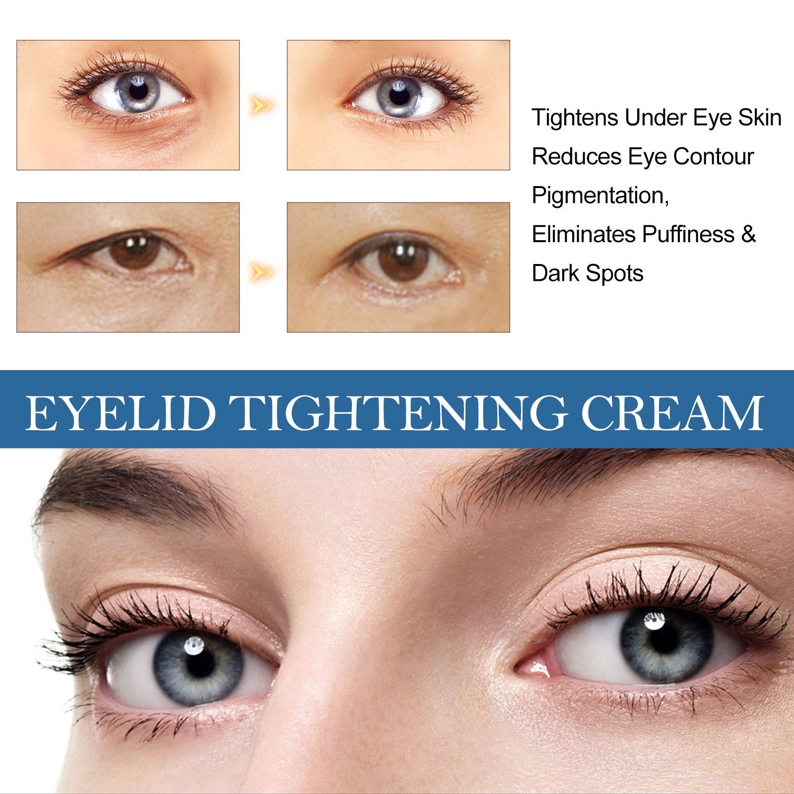Eye and Neck Cream to Fade Fine Lines Improve Skin Elasticity - Teleplus eye neck cream fade skin fine lines