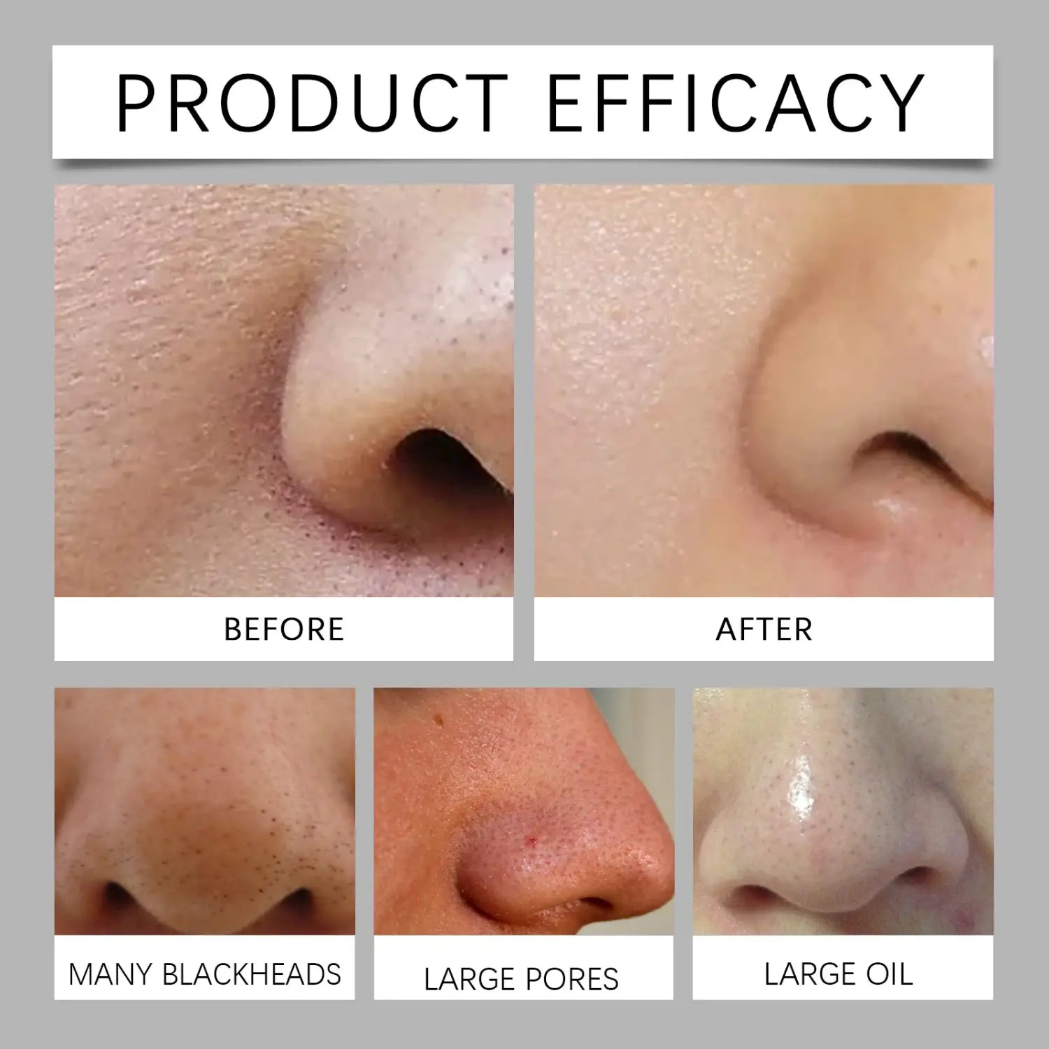 Black Nose Mask for Gentle Cleaning and Clearer Skin 30g