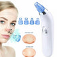 Facial Pore Cleaner - Say Bye to Pores with the Facial Pore Cleaner 2 AA Batteries