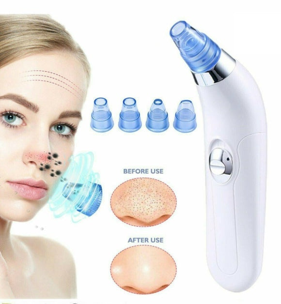 Facial Pore Cleaner - Say Bye to Pores with the Facial Pore Cleaner 2 AA Batteries