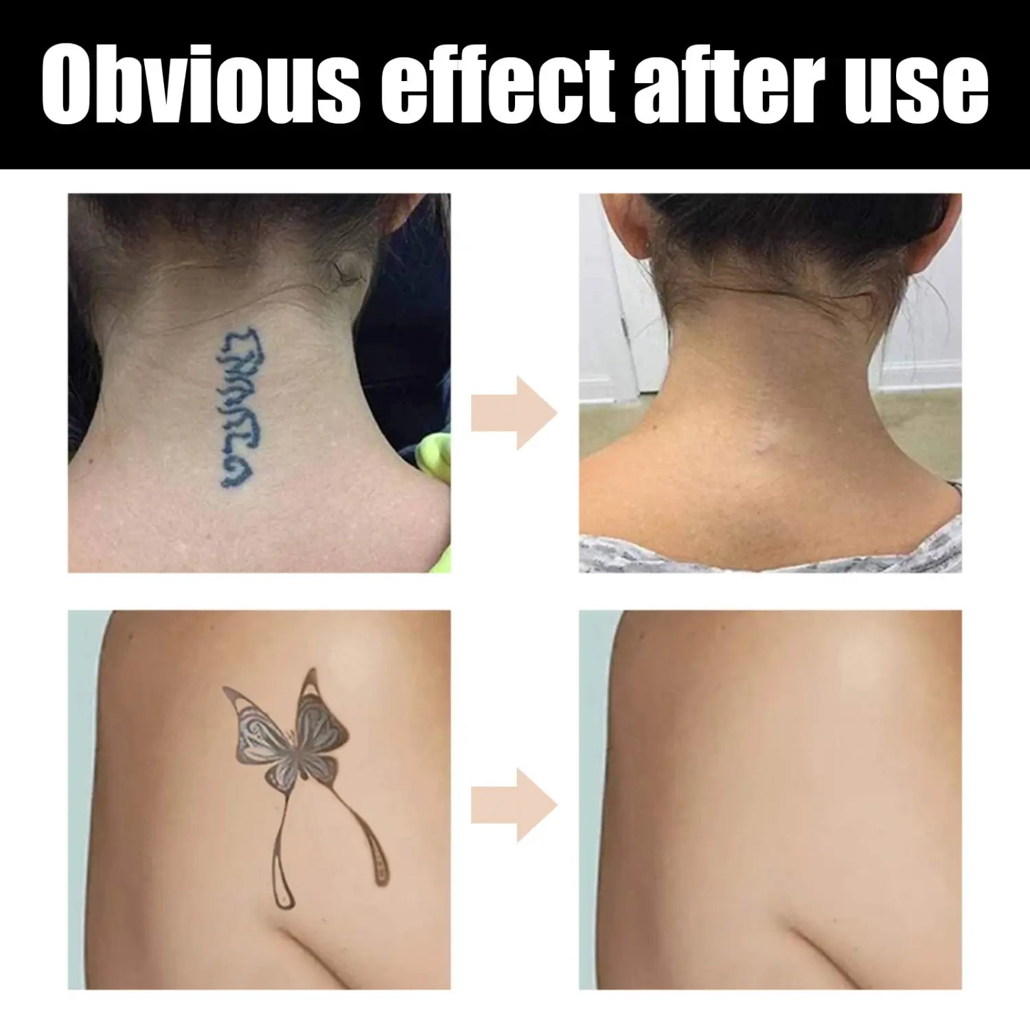 Waterproof Brightening Cover Concealer for Tattoos Scars Birthmarks