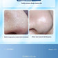 Female Household Pore Cleaning Import Oxygen Injection Skin Spray Electric Beauty Instrument - Say Goodbye to Pores