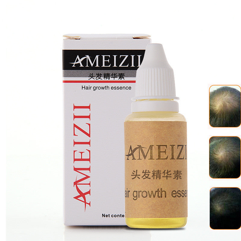 Foreign Trade Explosion Model Unisex Ameizii Hair Ginger Shampoo Care - Foreign Trade Explosion Model Unisex Ginger