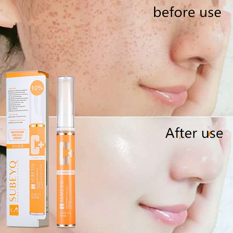 CHF Freckle Cream 15g for All Skin Types United States - the Spot-On Beauty Guru united states chf freckle cream