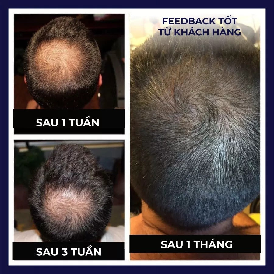 Frizz Control Hair Oil for Dry and Frizzy 50ml Natural Nourishing Treatment - Teleplus teleplus frizz control hair