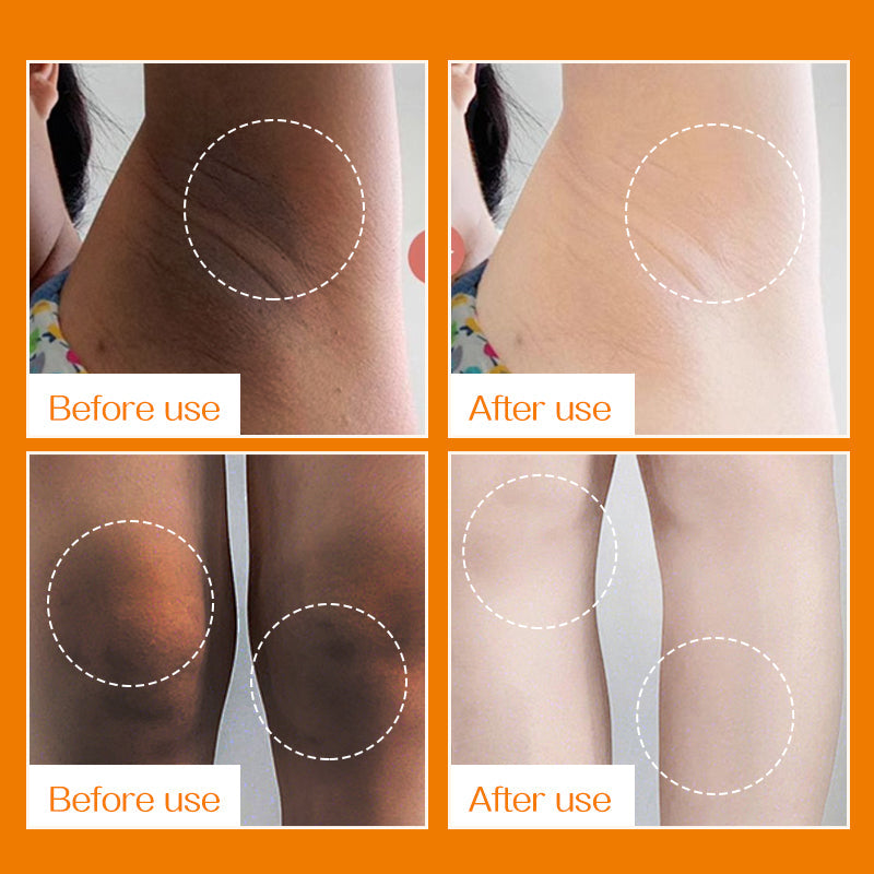 Gentle Hair Removal Cream for Smooth Skin and Sensitive Areas