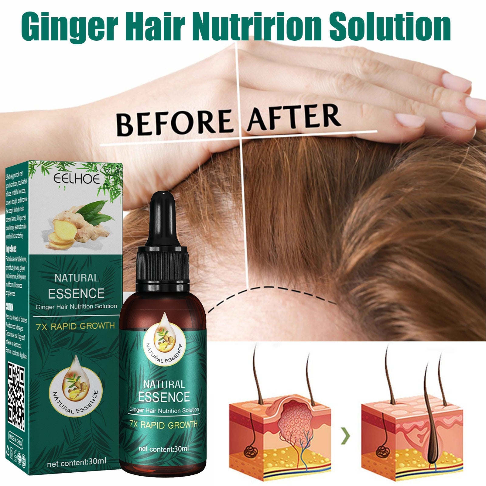 Ginger Hair Follicle Repair Essential Oil for Care and Regrowth - essential oil hair care net content