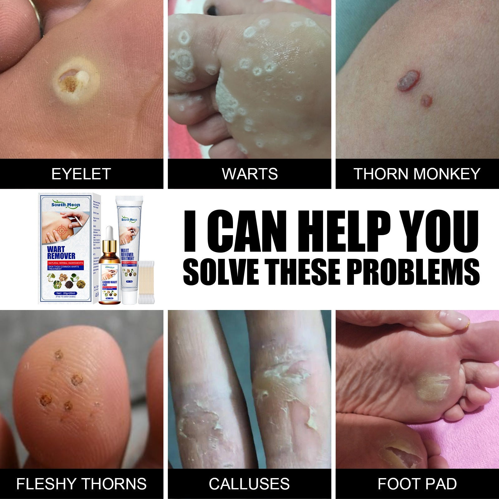 Herbal Wart Liquid and Gram Cream Set for Removal - Set: Say Bye to Warts with Herbs gram wart cream set herbal liquid