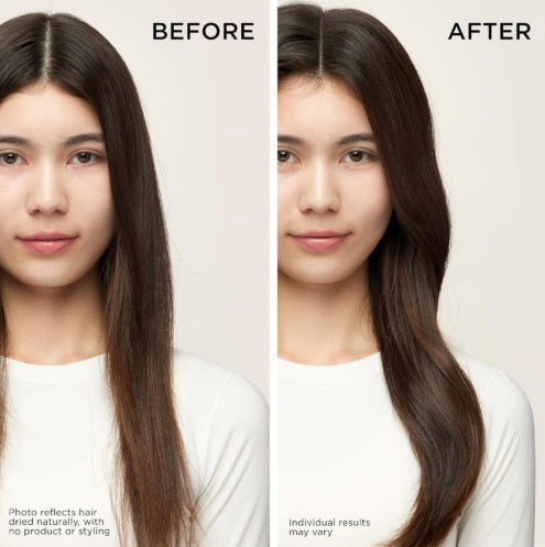 Hair Growth Serum for Thinning Regrowth Treatment and Scalp Care Essence - Teleplus