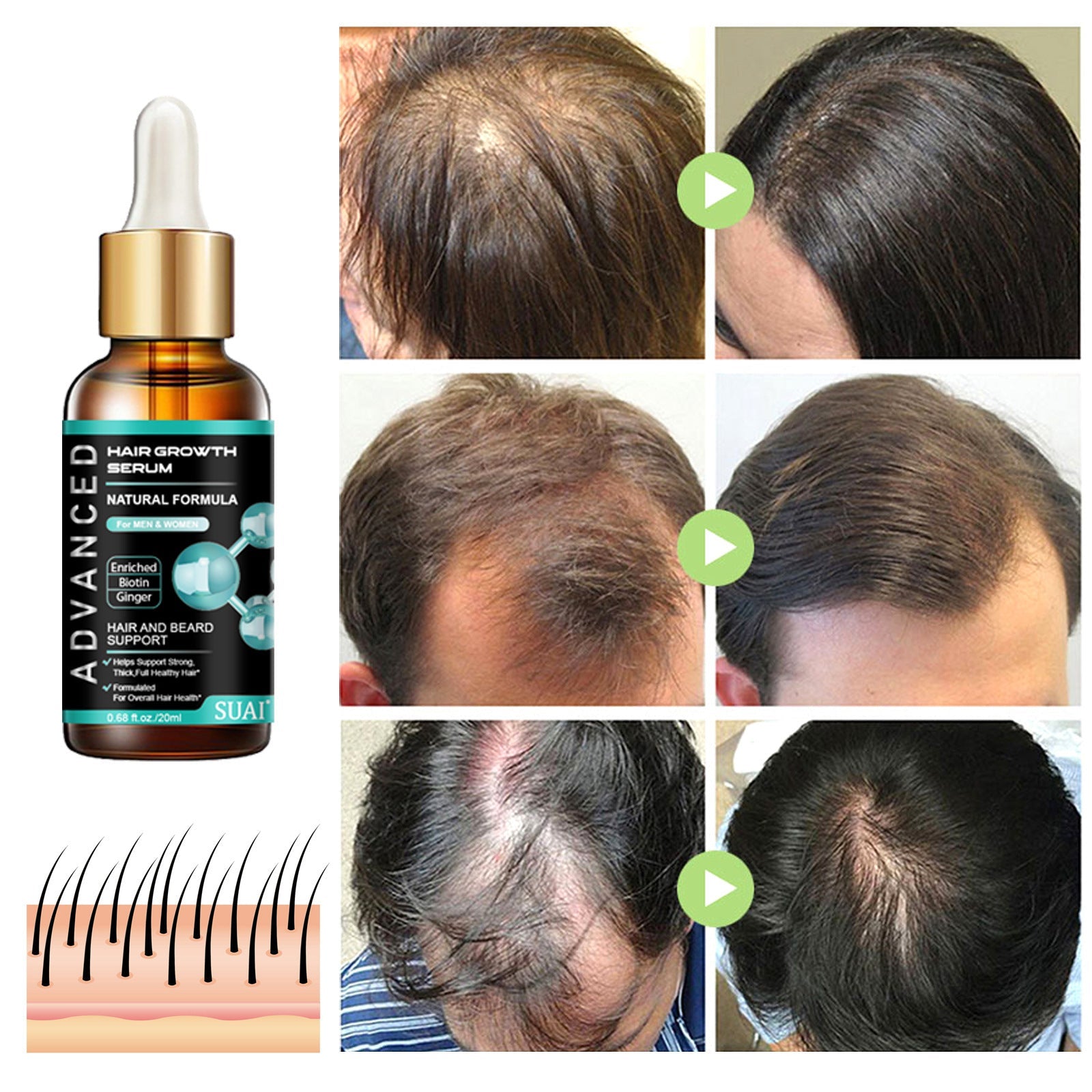 Hair Nutrient Solution for Frizzy 20ml Oil Treatment - Teleplus hair nutrient solution frizzy oil treatment