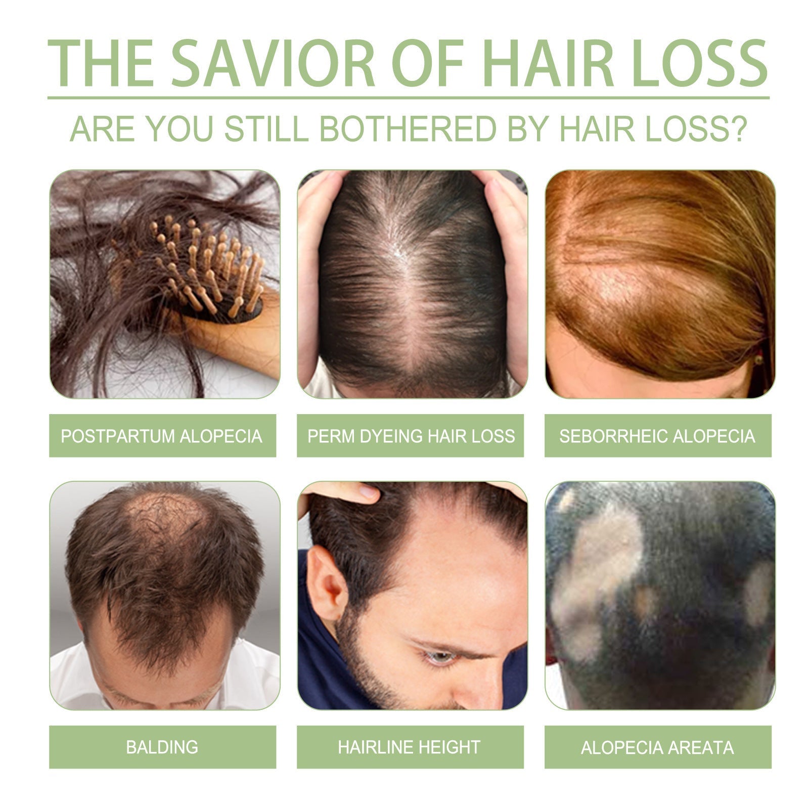 Herbal Density Hair Oil with Coconut Rosemary Nut Sesame Extract 100ml - hair oil