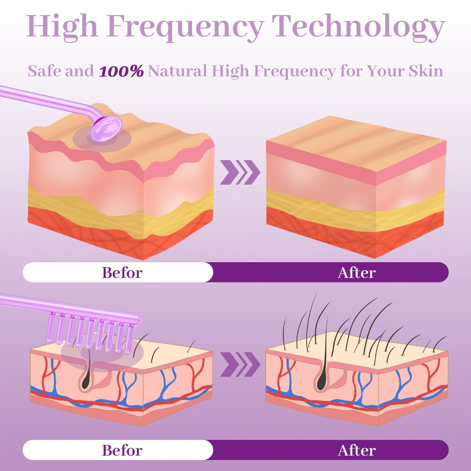 High Frequency Beauty Equipment with Wave Electrotherapy Rod for Skin Rejuvenation - Zap Your Fun high wave