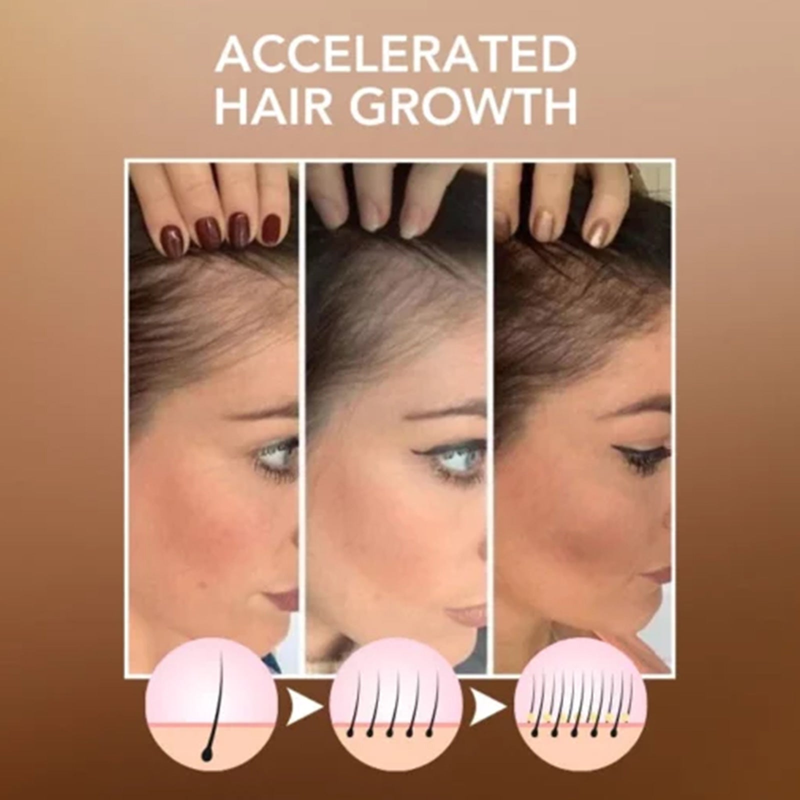 Hoegoa Moroccan Hair Care Essential Oil 100ml for Disposable Treatment - hoegoa moroccan hair care disposable