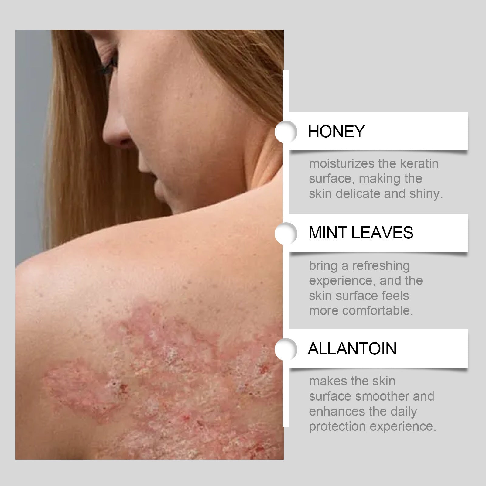 Honey Mint Allantoin Repair Cream for Skin Care 5x5x4.9cm - Teleplus allantoin repair cream honey mint leaves