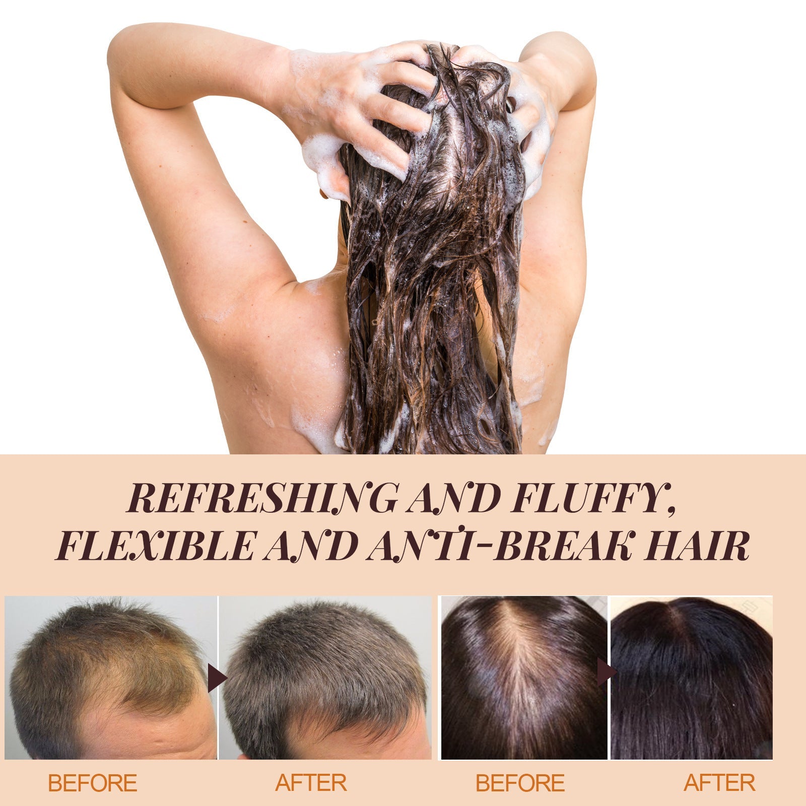 Horse Oil Shampoo for Deep Cleansing Scalp and Dandruff - horse oil shampoo deep cleansing scalp dandruff