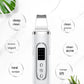 Household Beauty Ultrasonic Skin Cleaner for Blackhead Removal Black Tool - Say Goodbye to Blackheads with Magic