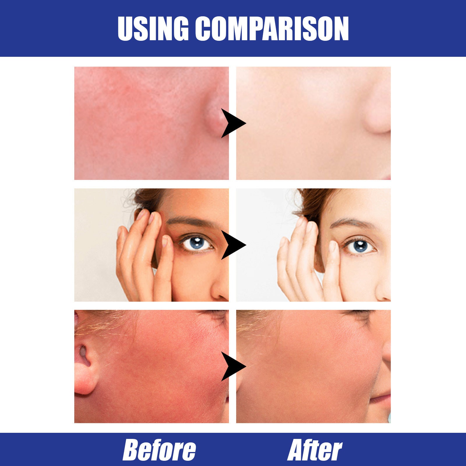 Hyaluronic Acid Sun Block Stick Moisturizing Sunscreen for Face - hyaluronic acid sun moisturizing sunscreen block stick