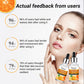 Hyaluronic Acid Vitamin C Face Serum Whitening - Brighten Any Skin Type with Witty Hyaluronic Serum