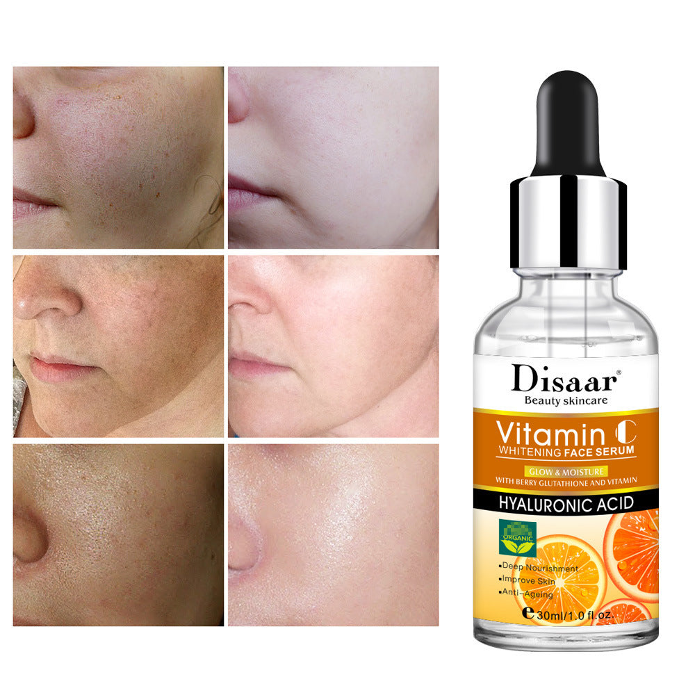 Hyaluronic Acid Vitamin C Face Serum Whitening - Brighten Any Skin Type with Witty Hyaluronic Serum