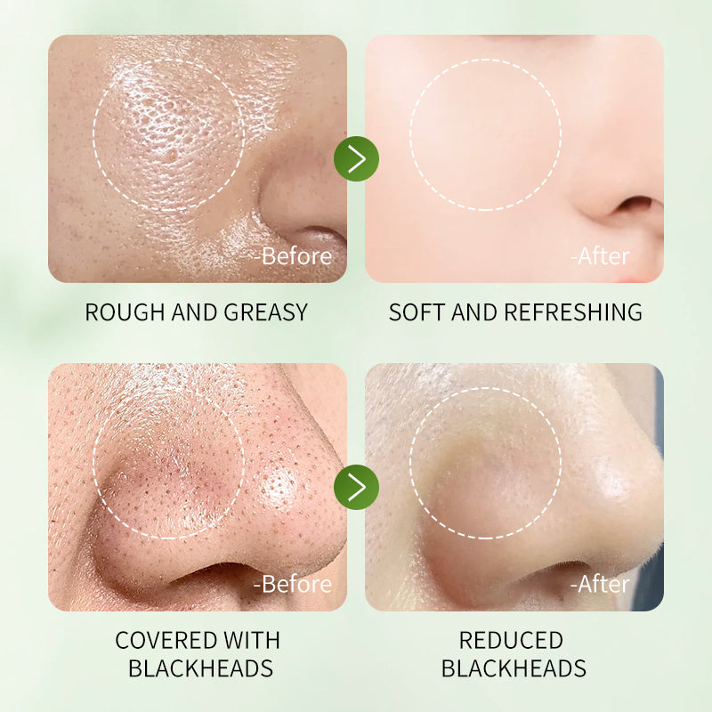 Hydrating Face Mask for Glowing Skin Deep Cleansing and Moisturizing Care