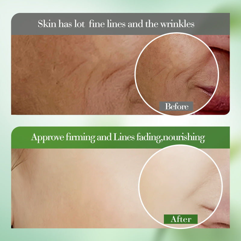 Hydrating Face Moisturizer Cream for All Skin Types 50g Anti Aging Skincare - Teleplus