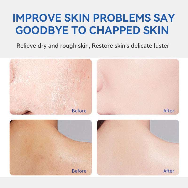 Hydrating Face Moisturizer for Dry Skin Anti Aging Cream Natural Skincare - Teleplus