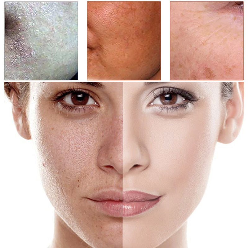 Hydrating Repair Hyaluronic Acid Serum with Aloe and Centella for Skin Rehabilitation - Sunkissed Skin’s Best Friend