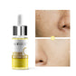 Hydrating Moisturizing Increase Elasticity Serum - Hydrating Moisturizing Increase Elasticity Serum Delight