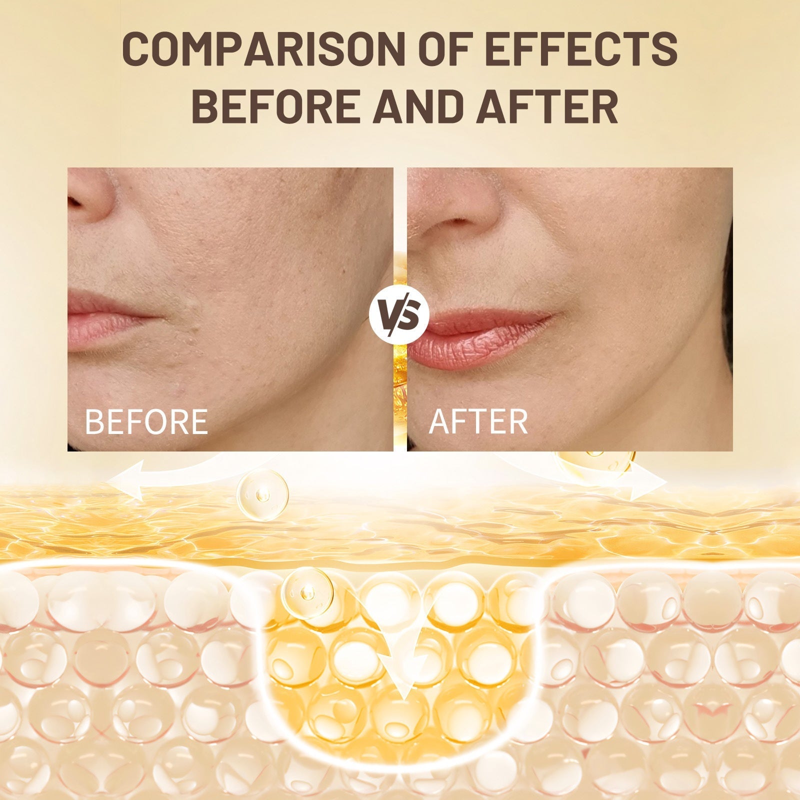 Hydrating Skin Cream for Normal Moisturizing Body Care 120 ml - skin cream