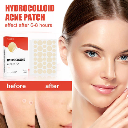 Hydrogel Acne Patch with Invisible Breathable Repair 144pcs - Magic invisible breathable repair hydrogel acne patch