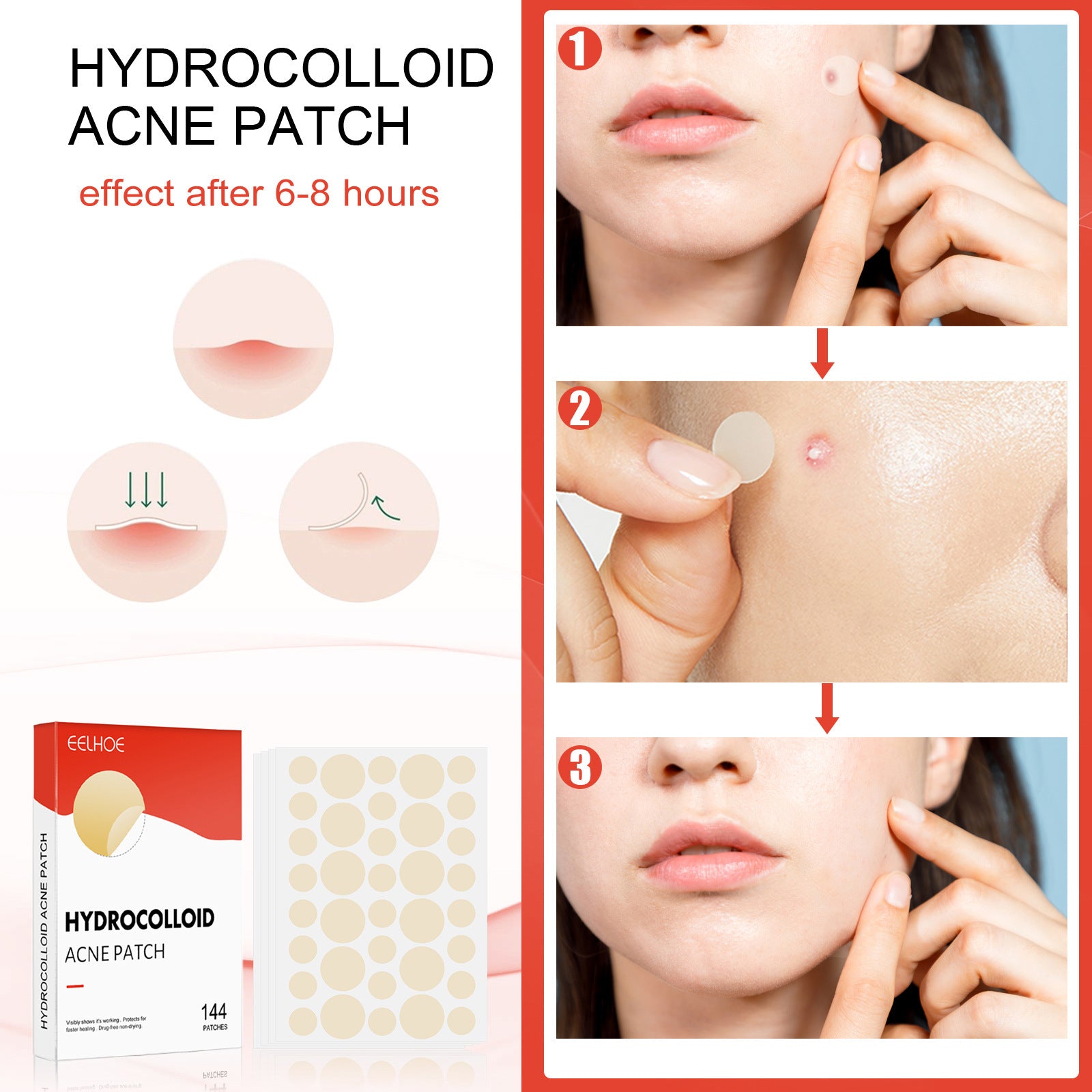 Hydrogel Acne Patch with Invisible Breathable Repair 144pcs - Magic invisible breathable repair hydrogel acne patch
