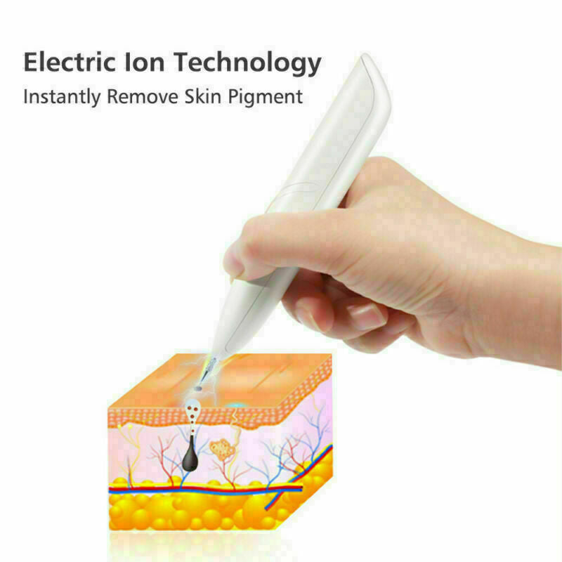 Ion Laser Freckle Skin Mole Dark Spot Remover Face Wart Tag Tattoo Removal Pen - Zap Away Freckles with Ion Laser Magic