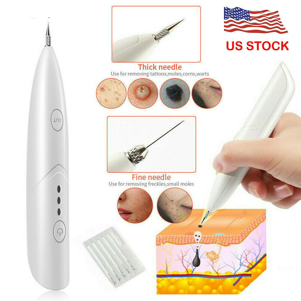 Ion Laser Freckle Remover for Face Warts Skin Moles and Dark Spots - Zap Away Freckles with Magic Pen ion laser freckle