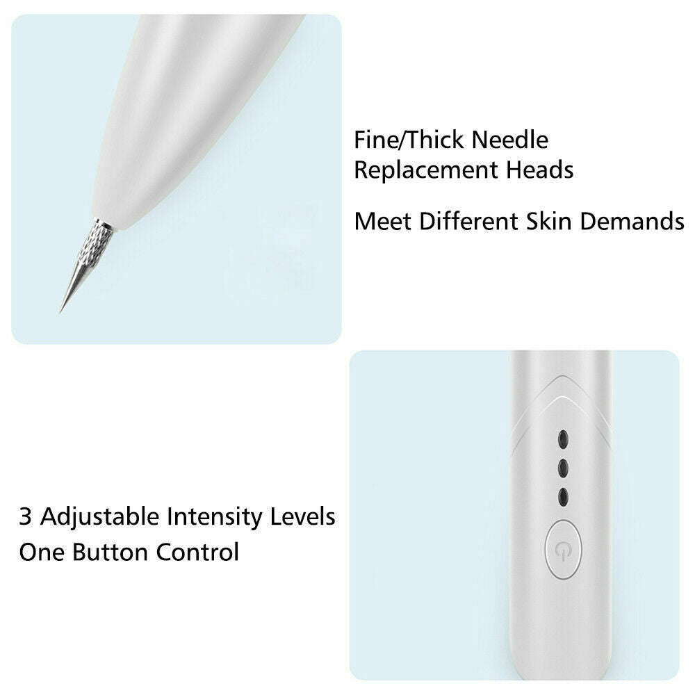 Ion Laser Freckle Skin Mole Dark Spot Remover Face Wart Tag Tattoo Removal Pen - Zap Away Freckles with Ion Laser Magic