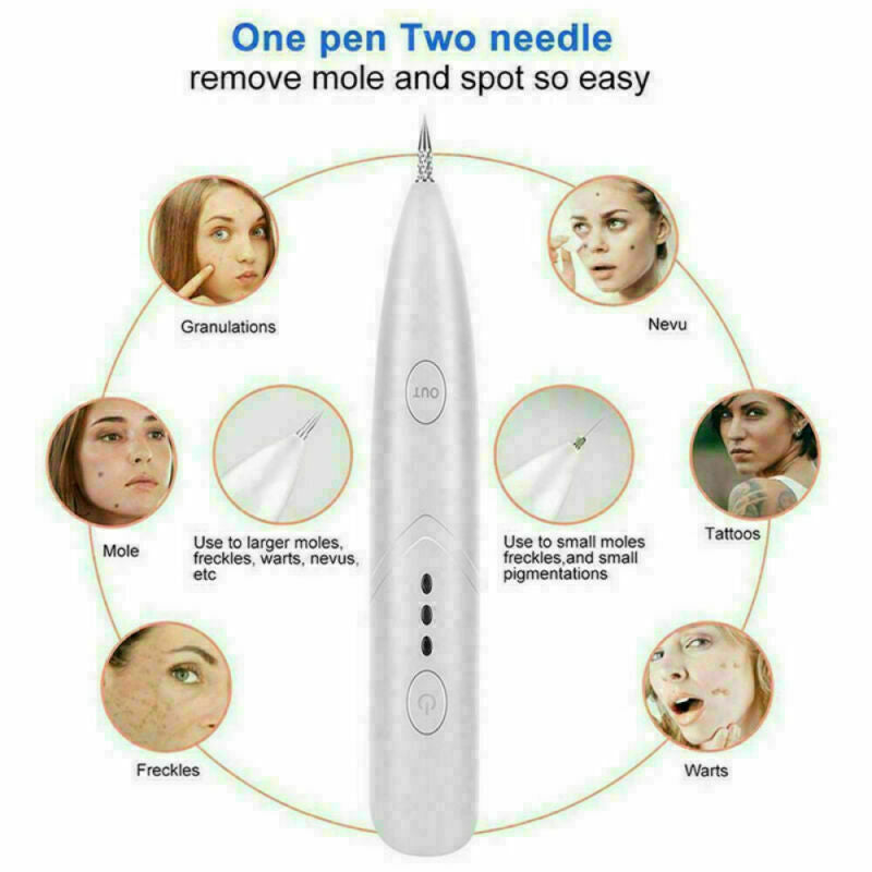 Ion Laser Freckle Skin Mole Dark Spot Remover Face Wart Tag Tattoo Removal Pen - Zap Away Freckles with Ion Laser Magic