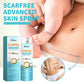 Lighten Scar Care Spray On Body Skin - Lighten Scar Care Spray for Smoother Body Skin