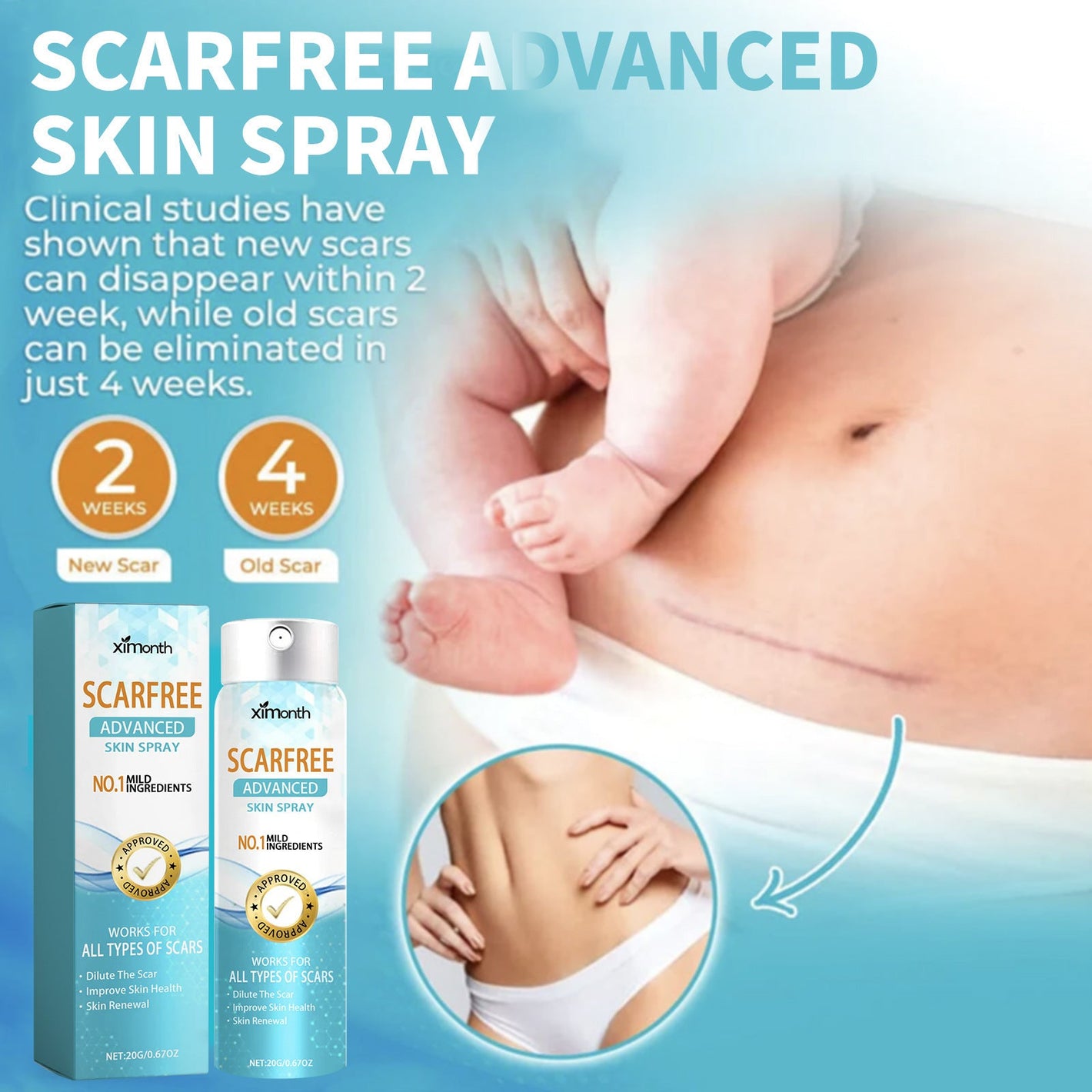Lighten Scar Care Kit with Spray for Body Skin Relief - Smoother lighten scar care spray body skin