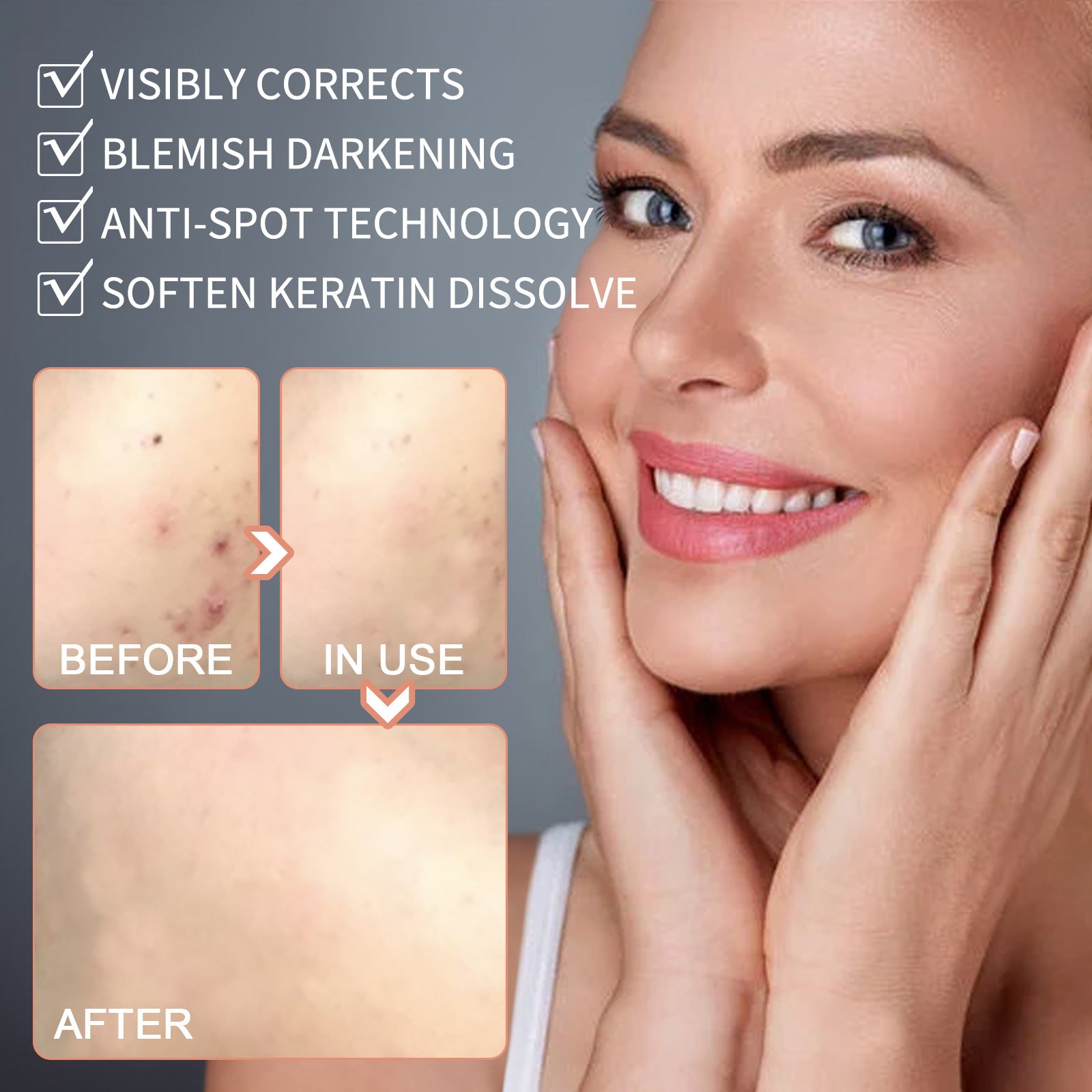 Liquid Body Fading and Skin Cleansing Cue Solution 30ml Boxed - Teleplus skin cleansing cue liquid body fading