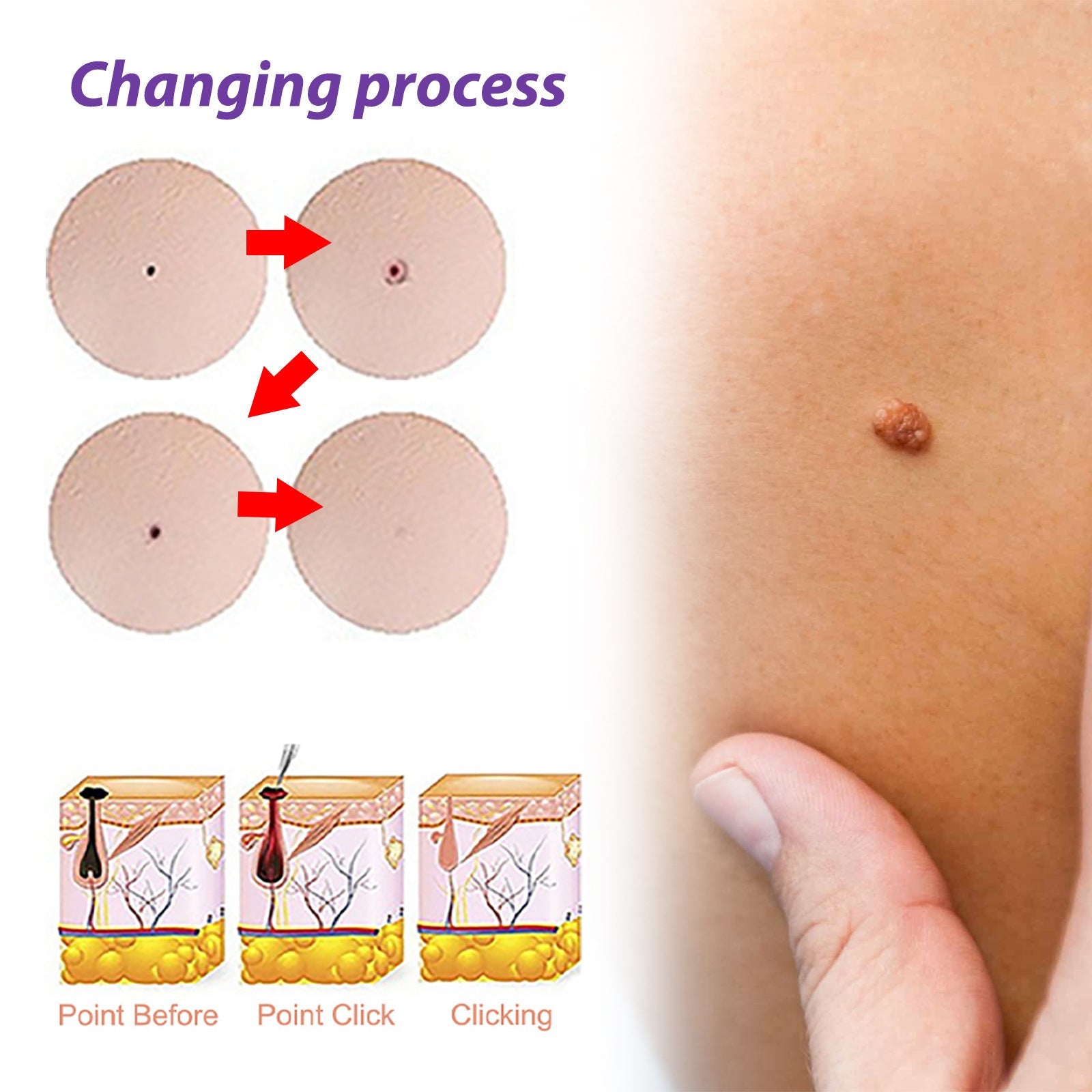 Liquid Body Fading and Skin Cleansing Cue Solution 30ml Boxed - Teleplus skin cleansing cue liquid body fading