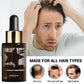 Men’s White Hair Growth Oil for Dense 30ml Black Essence - Teleplus dense hair